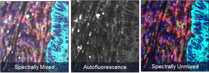 Image of spectrally unmixed tissue compared to autofluorescence present on tissue and spectrally unmixed tissue.