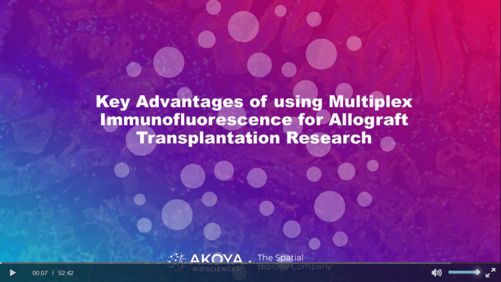 Webinar thumbnail: "Key Advantages of Using Multiplex Immunofluorescence for Allograft Transplantation Research"