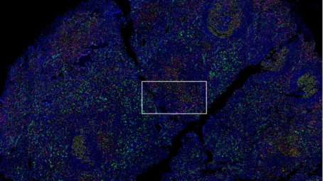 zeiss-Human-lymph-node-imaged-with-14-antibody-codex-panel-1200x794