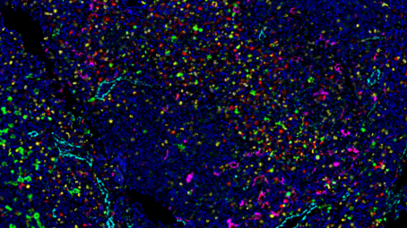 zeiss-Human-lymph-node-imaged-with-14-antibody-codex-panel-inset-1200x675