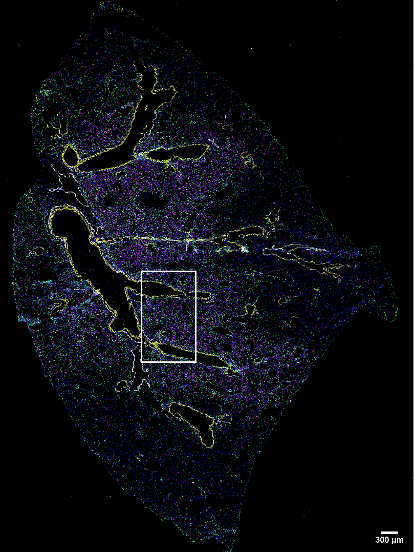 zeiss Mouse Lung Imaged With 37 antibody codex panel