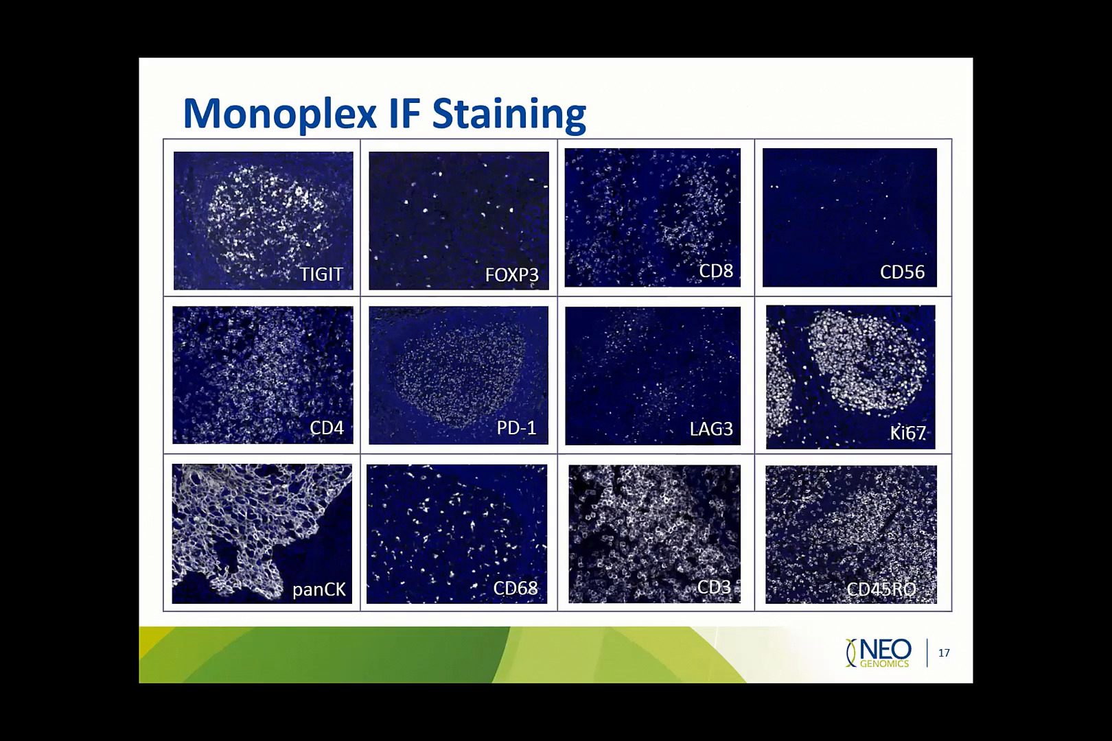 video-profiling-exhausted-t-cells-using-vectra-polaris-multiplex-immunofluorescence-assay