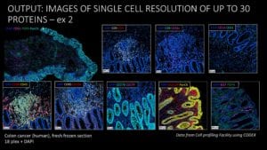 Images of single-cell resolution of up to 30 proteins in human fresh-frozen sections of colorectal cancer. Data from the Cell Profiling Facility using CODEX.