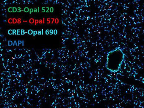 opal secondary antibodies 1 1