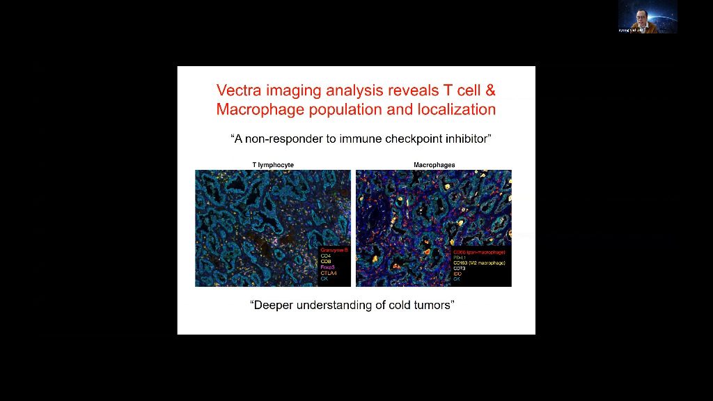 video-talk-2-understanding-tumor-immune-microenvironment-using-multispectral-imaging