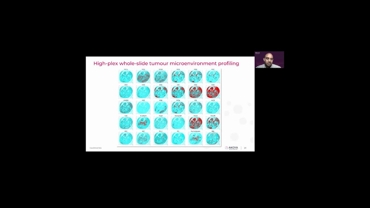 video-spatial-phenotyping-in-the-era-of-immunotherapy