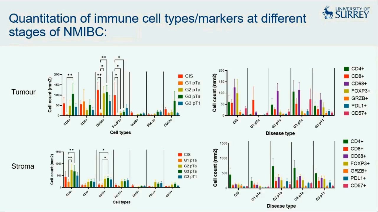 video-understanding-the-immune-landscape-of-non-muscle-invasive-bladder-cancer-nmibc-and-its-influence-on-bcg-immunotherapy
