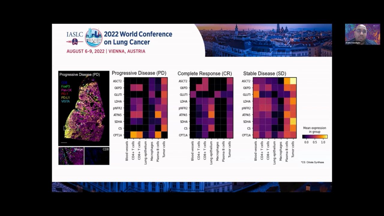 Video-APAC-spatial-2023-multi-omic-spatial-delineation-of-immunotherapy-response