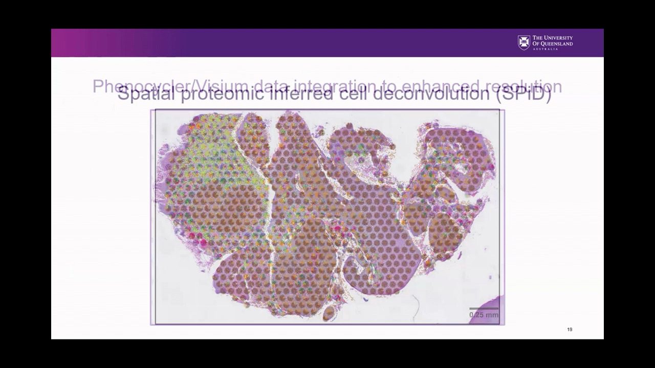 video-AU-spatial2023-clinical-implementation-of-spatial-proteomic-data-for-cancer-treatment-personalization