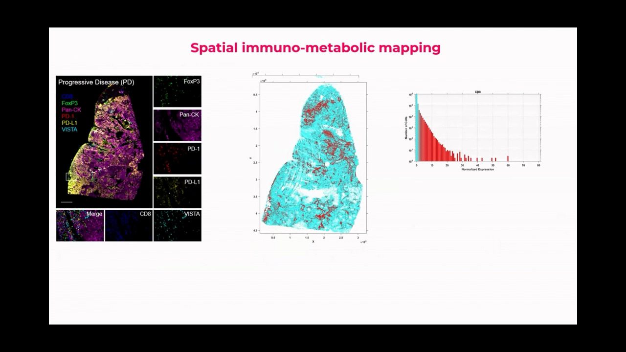 video-AU-spatial2023-multi-omic-spatial-delineation-of-immunotherapy-response