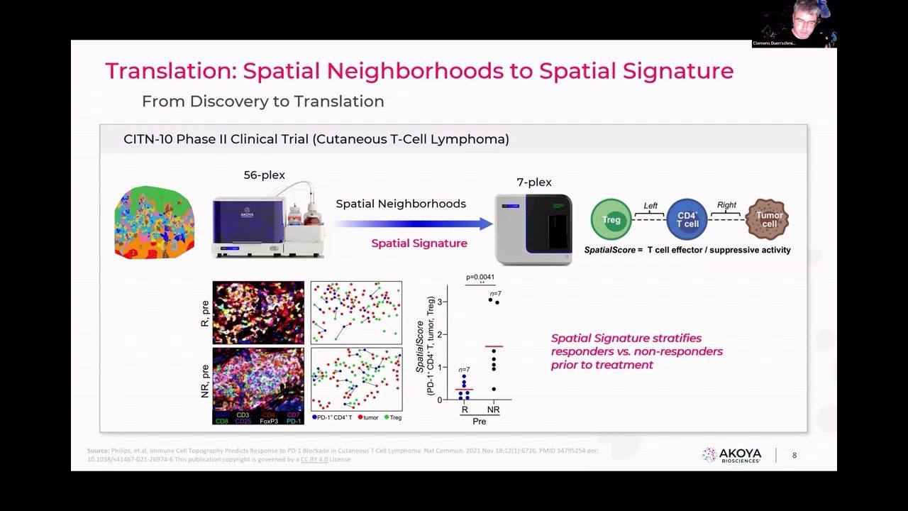 video-AU-spatial2023-uncovering-new-insights-in-tumor-biology-and-beyond