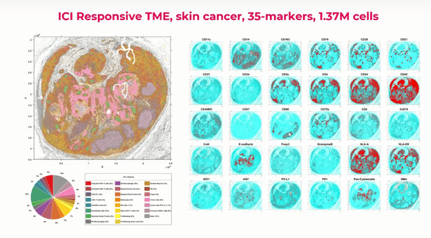 ICI Responsive TME skin cancer 35 marker panel