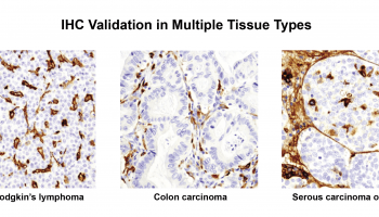 Ab_validation_in_multiple_tissue_types-01