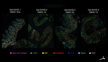 Tissue images showing progression of gut GvHD