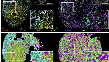 7-color multiplex immunofluorescence images of colorectal cancer from Crohn's like reaction and diffuse inflammatory infiltration patient groups and accompanying voronoi plots.