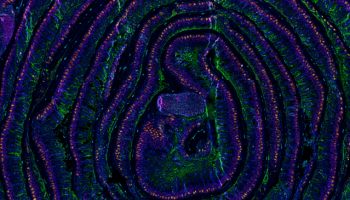zeiss-Mouse-Small-Intestine-Imaged-With-14-antibody-codex-panel-1024x365