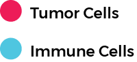 interactions and cell densities of tumor and immune
