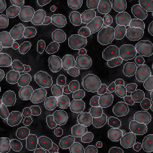 akoya cell segmentation image 02